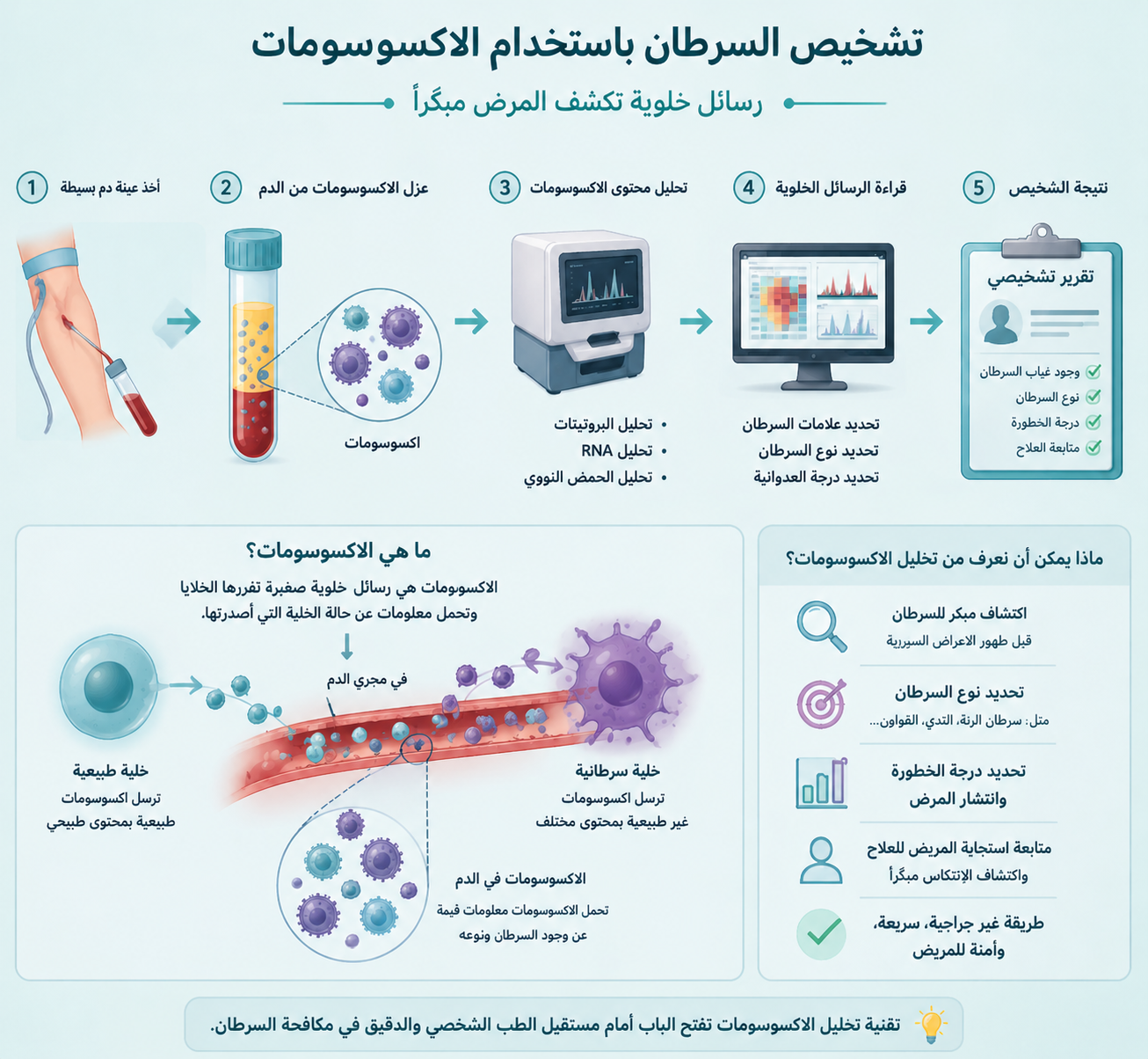 تشخيص الاكسوسومات